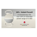 革命的眼内レンズのInFo Instant Focus©をより広範な度数範囲で提供