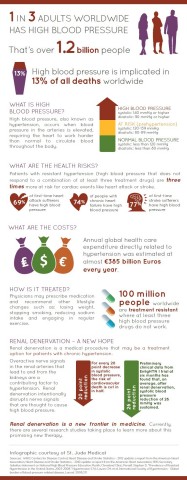 The global numbers behind hypertension and renal denervation. (Graphic: St. Jude Medical, Inc.)