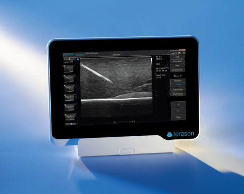 New uSmart 3200T Ultrasound System with enhanced image quality and advanced features in less than five pounds! (Photo: Business Wire)