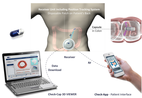 Check-Cap imaging system. (Graphic: Business Wire) 