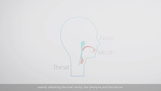 European Head and Neck Society video explaining what head and neck cancer is, including incidence, symptoms and risk factors
