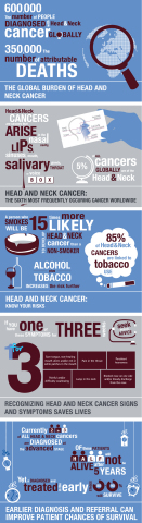 Handy visual information on head and neck cancer (Graphic: Business Wire)