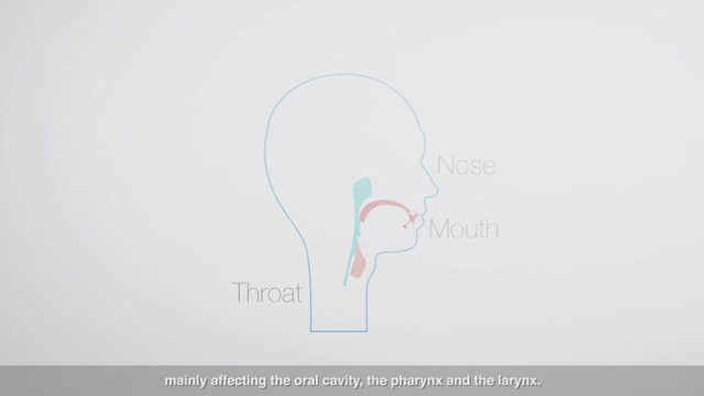 European Head and Neck Society video explaining what head and neck cancer is, including incidence, symptoms and risk factors