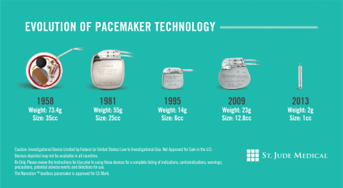 Timeline demonstrating the evolution of pacing technology from 1958 to 2013. (Graphic: Business Wire) 