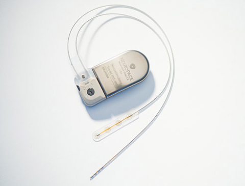 The RNS(R) System has been granted premarket approval (PMA) from the FDA for the treatment of adults with partial onset seizures that have not been controlled with two or more antiepileptic drugs. The RNS System is a novel, implantable therapeutic device that delivers responsive neurostimulation, an advanced technology designed to detect abnormal electrical activity in the brain and respond by delivering imperceptible levels of electrical stimulation to normalize brain activity before an individual experiences seizures. (Photo: Business Wire)