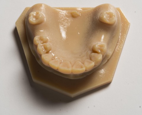 A 3D Printed dental model using VeroDentPlus and produced on the OrthoDesk 3D printer (Photo: Business Wire)