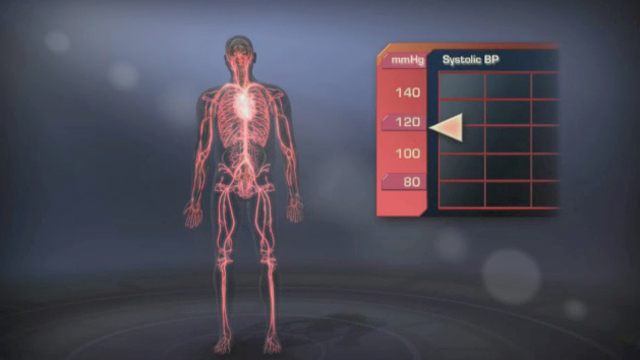 Neurogenic Orthostatic Hypotension: A medical animation video that explains this condition.