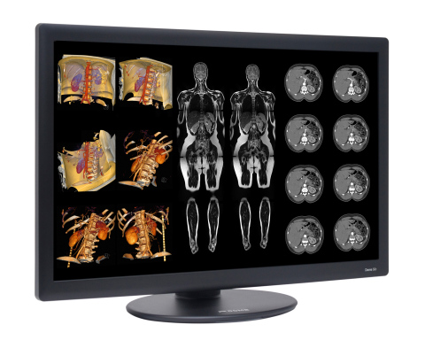 Dome S6c Widescreen 6MP Radiology Display (Photo: Business Wire)
