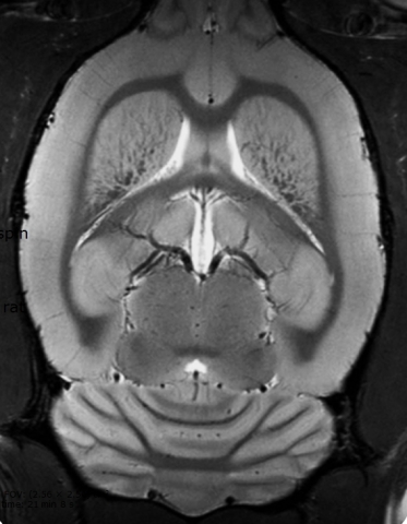 Ultra-high resolution in vivo rat brain imaging using the Array MRI CryoProbe. (Photo: Business Wire)