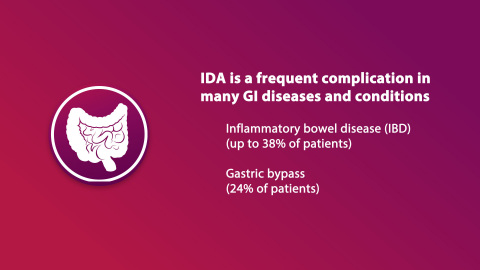 Iron deficiency anemia is a frequent complication in many GI conditions, including inflammatory bowel disease, and in patients who have undergone gastric bypass surgery (Graphic: Business Wire)