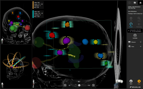 Automatic Brain Metastases Planning Element, the latest software innovation by Brainlab, provides new treatment possibilities for larger tumors and higher numbers of metastases.
(Photo: Business Wire)