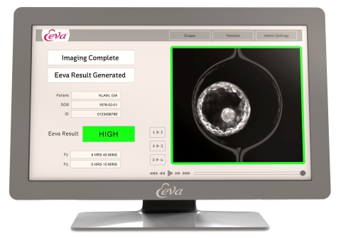 The Eeva System user station (Auxogyn, Inc.)