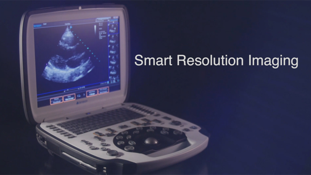 Terason uSmart 3300 Ultrasound System is a fusion of Smart Technology and Smart Resolution Imaging to deliver innovative and intuitive systems with elite performance.