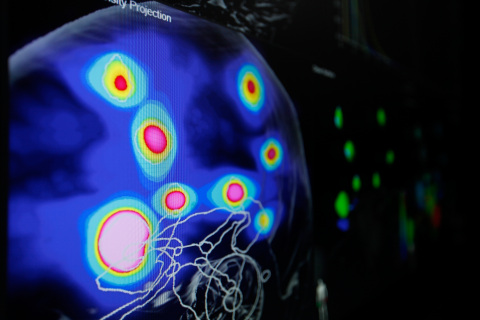 Automatic Brain Metastases Planning Software by Brainlab (Photo: Business Wire) 