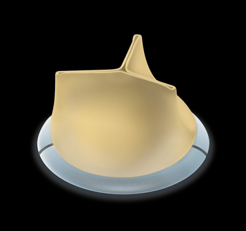 SORIN GROUP's CROWN PRT HEART VALVE (Photo: Business Wire)