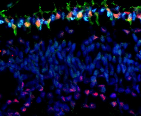 Microscopic view of the retina. Green coloring indicates outline of cone cells. (Photo: Business Wire)