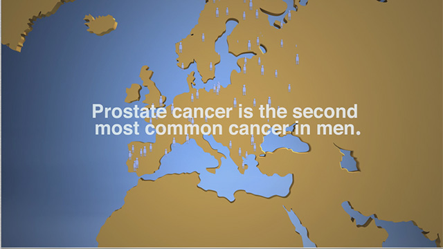 PROSTATE CANCER DISEASE ANIMATION