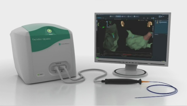 Animation of the TactiCath Quartz irrigated ablation catheter.