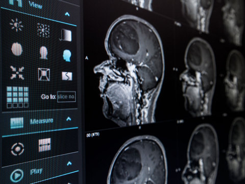 Quentry(r) Image Sharing and Collaboration used by Radiating Hope Charity to Connect Clinical Experts with Radiation Clinics in Developing Countries. (Photo: Business Wire)