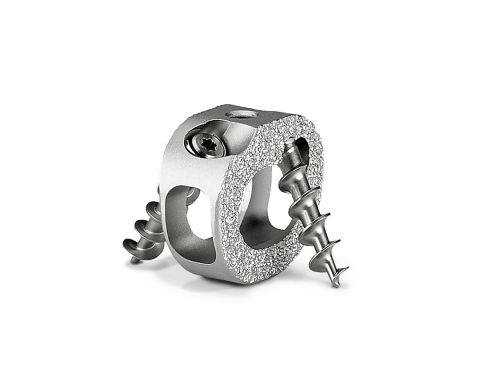 Endoskeleton® TCS Device for Cervical Fusion with Integrated Fixation (Photo: Business Wire)