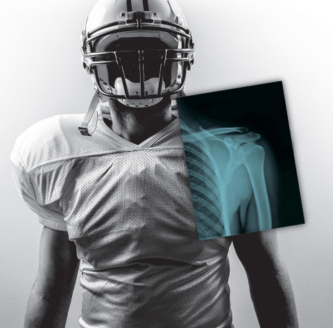 The CARESTREAM DRX-1 detector produces high-quality diagnostic images in seconds. It is being used to produce X-ray exams during the 2015 NFL Scouting Combine. (Photo: Business Wire)