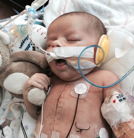 When he was just five days old, Jackson Lane underwent a 13-hour operation that would save his life. (Photo: Business Wire)