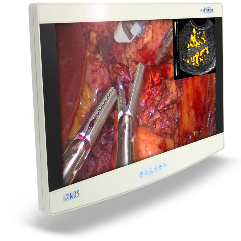 27" Radiance Ultra surgical visualization platform with edge-to-edge Corning(R) Gorilla(R) Glass (Photo: Business Wire)