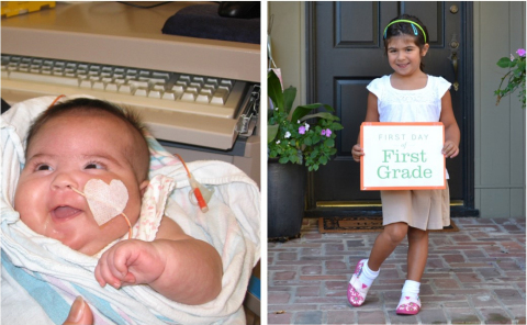 Isabella (left) at Lucile Packard Children's Hospital Stanford in September 2008, before a successful treatment for her airway hemangioma was found. Isabella (right) is now a first grade student in Sacramento, Calif. (Photo: Business Wire)