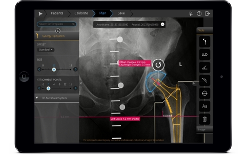 TraumaCad(R) Orthopedic Pre-operative Planning and Templating Solution Receives FDA Clearance on New Mobile Version (Photo: Business Wire)