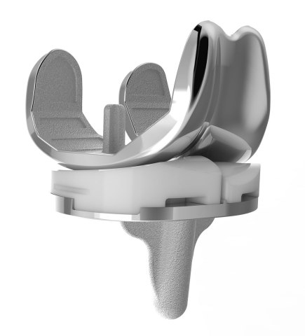 ConforMIS iTotal® customized total knee replacement (Photo: Business Wire)