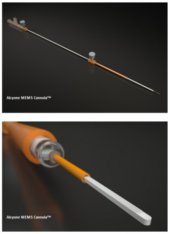 Alcyone MEMS Cannula™ (Graphic: Business Wire)