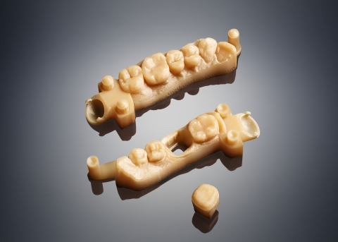 Crown and bridge stone models produced with MED690 material on the Objet30 Dental Prime 3D Printer. (Photo: Stratasys Ltd.)