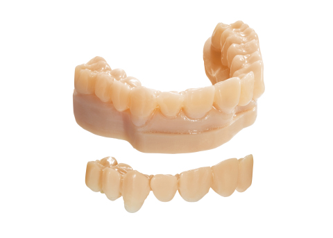 Diagnostic wax-ups produced with MED620 material on the Objet30 Dental Prime 3D Printer (Photo: Stratasys Ltd.)
