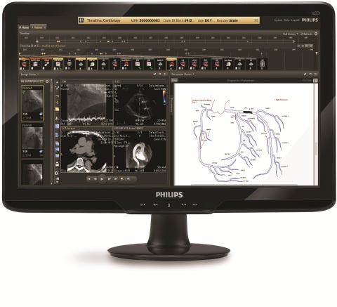 Philips Features New IntelliSpace Cardiovascular Image and Information Management at Toronto’s Canadian Cardiovascular Congress (Photo: Business Wire)