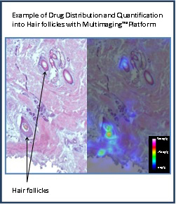 Example of Drug Distribution and Quantification into Hair follicles with Multimaging™ Platform (Photo:Imabiotech)