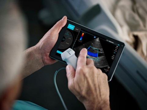 iViz is a highly portable ultrasound augmented with mobile computing and advanced connectivity, empowering providers to practice visual medicine when and where needed.