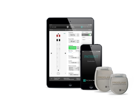 The Proclaim Elite SCS System from St. Jude Medical prioritizes patient convenience, comfort and pain relief to shift patient focus from their chronic pain therapy toward their quality of life. (Photo: Business Wire)
