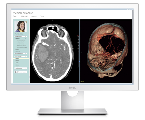 The Dell Medical Review 24 Monitor addresses common needs of a healthcare environment with precise, DICOM-ready images and a fully cleanable design for effective infection control. (Photo: Business Wire)