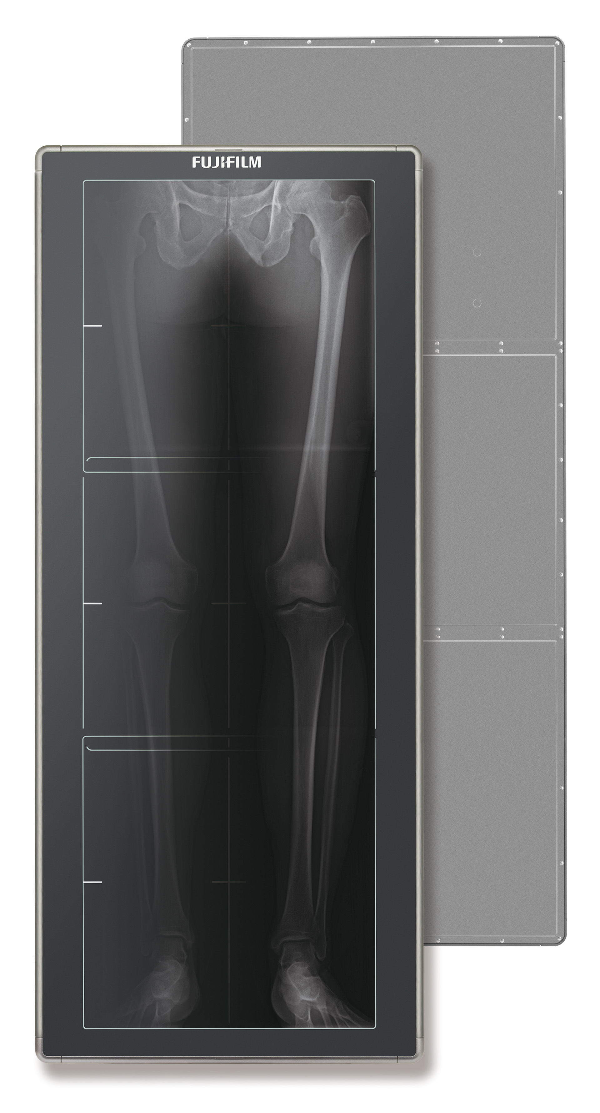 Fujifilm Showcases World’s First Long-Length Digital Radiography ...