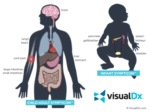 As part of the new VisualDx tool, Sympticons visually depict symptoms and potential disease impacts on a patient based on age. (Graphic: Business Wire)