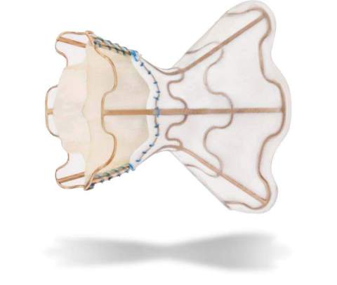 V-Wave Implantable Shunt (Photo: Business Wire)