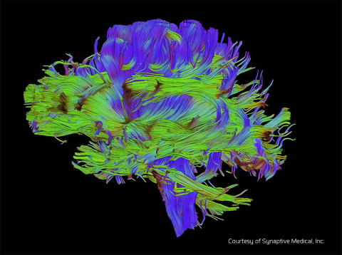 BrightMatter Plan image of the brain's fiber tracts
(Graphic: Business Wire)
