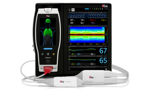 Masimo Root with O3 Regional Oximetry and SedLine Brain Function Monitoring (Photo: Business Wire)