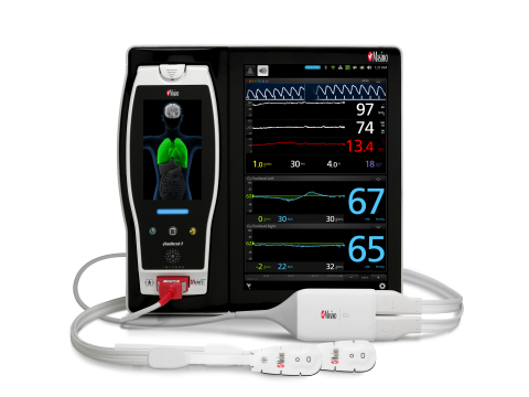 Masimo Anuncia la Marca CE para la Oximetría Regional O3™ Pediátrica