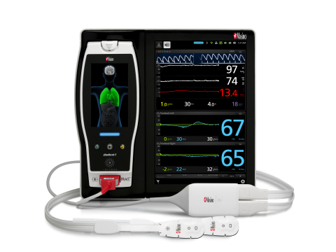 Masimo Root with SedLine and O3 with Pediatric Sensor (Photo: Business Wire)