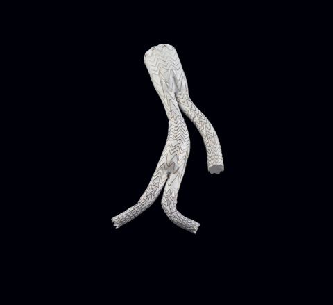 GORE® EXCLUDER® Iliac Branch Endoprosthesis (IBE) (Photo: Business Wire)