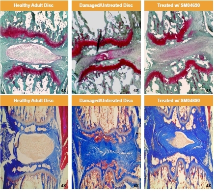 Images from intervertebral discs treated with vehicle or 33μg/mL SM04690 (C8/9 and C9/10) 8 weeks post-injury and stained with Safranin O/Fast Green (top panels) or Masson's Trichrome (lower panels) (Graphic: Business Wire)