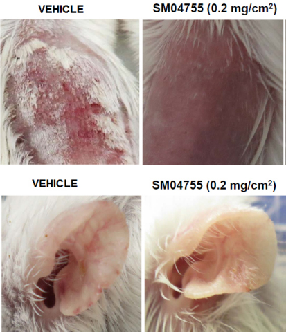 Images of skin (top panel) and ears (bottom panel) from (i) imiquimod (IMQ) and vehicle-treated or (ii) IMQ and SM04755 (0.2 mg/cm2)-treated mice on day 20 (Graphic: Business Wire)