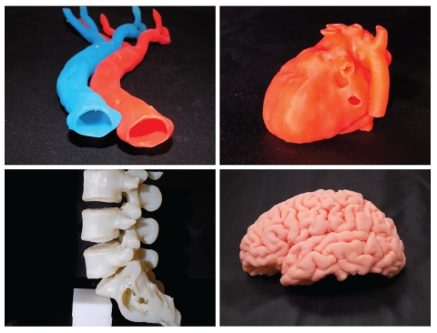 3D-printed organ models produced by SiMMo3D that make use of malleable and hard synthetic polymers. (Photo: Business Wire)