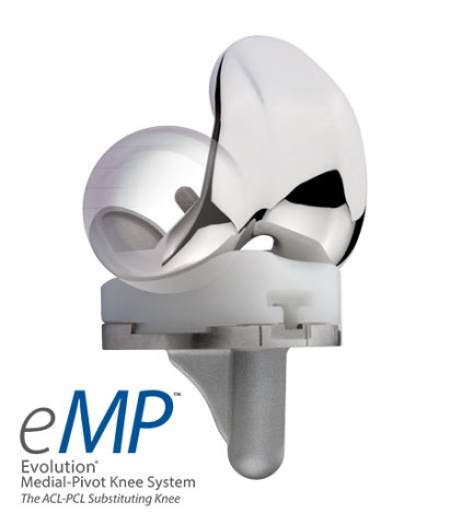 Evolution® Medial Pivot-Knee System (Photo: MicroPort Orthopedics)